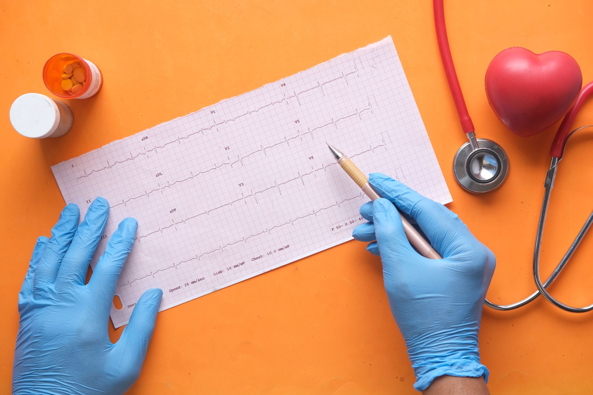 Analýza EKG křivky